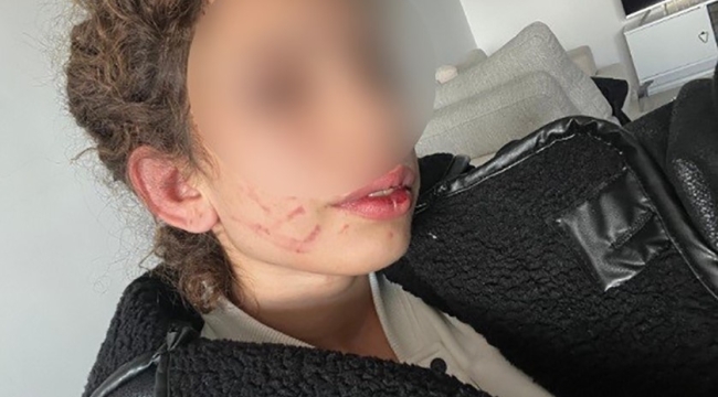 Konya'da 19 yaşındaki kızı darp eden gençten "kendi kendini yaraladı" savunması