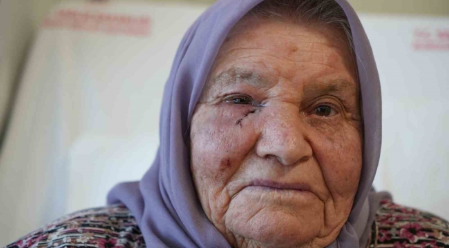 Dört mevsim gözyaşı yağmuru, bir cerrahiyle güneşle buluştu